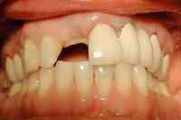 Smile Dental Implant Center - Dentists in White Rock