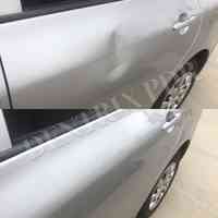 DenTrix Paintless Dent Removal