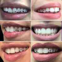 Wicked Tooth Gems & Piercings
