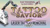 Tattoo Savior - Laser Tattoo Removal